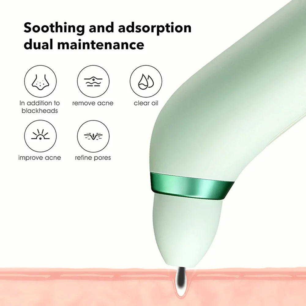Ametoys Pinjing Blackhead Remover Pore with 0.3MP Macro Camera/HD APP Display/2 Suction Probes/3 Modes Electric Blackhead Extractor Tool Pimple Extractor Facial Skin Care Beauty Tool