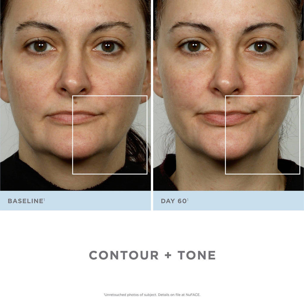Nuface Trinity Pro Complete Facial Toning Kit
