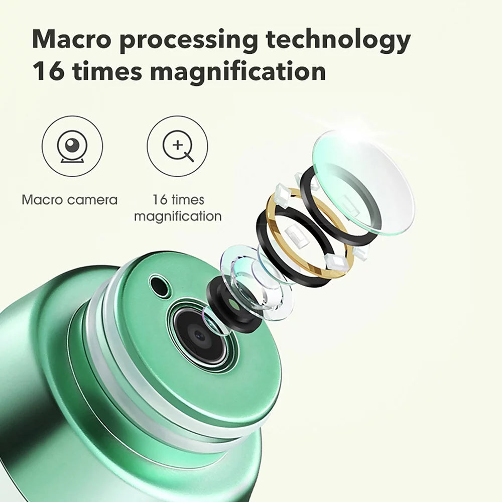 Ametoys Pinjing Blackhead Remover Pore with 0.3MP Macro Camera/HD APP Display/2 Suction Probes/3 Modes Electric Blackhead Extractor Tool Pimple Extractor Facial Skin Care Beauty Tool
