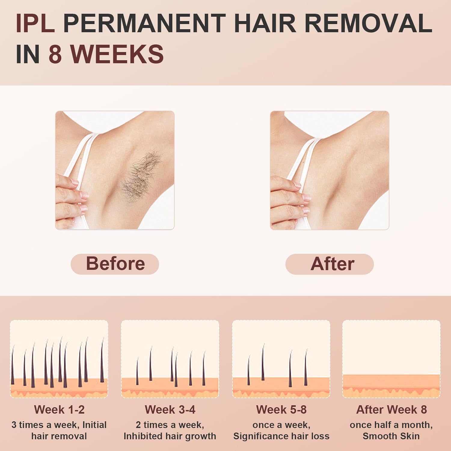 IPL Laser Hair Removal for Women and Men, Permanent and Painless Hair Removal Device, 999900 Flashes Body and Facial Hair Removal at Home with Cooling System